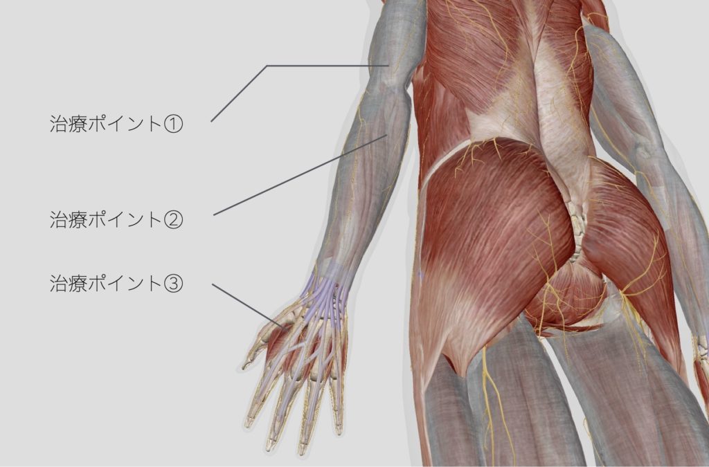 右手の甲を触ると痛みが走る・感覚がない症状