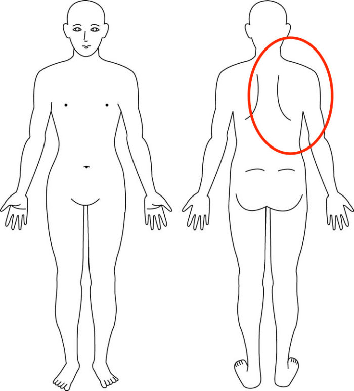 【症例】右の背中(肩甲骨内側)の痛み