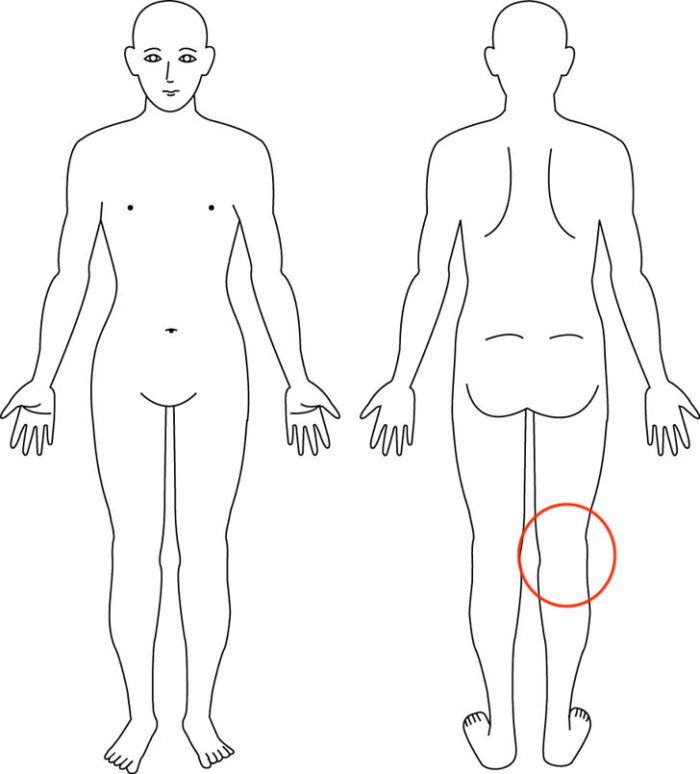 【症例】膝の痛みと腰～背中にかけての痛み